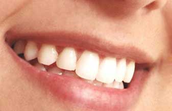 Ortoquality Inova Implantes - Foto 1