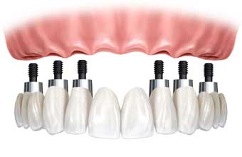 Dental Df Produtos Odontológicos - Foto 1